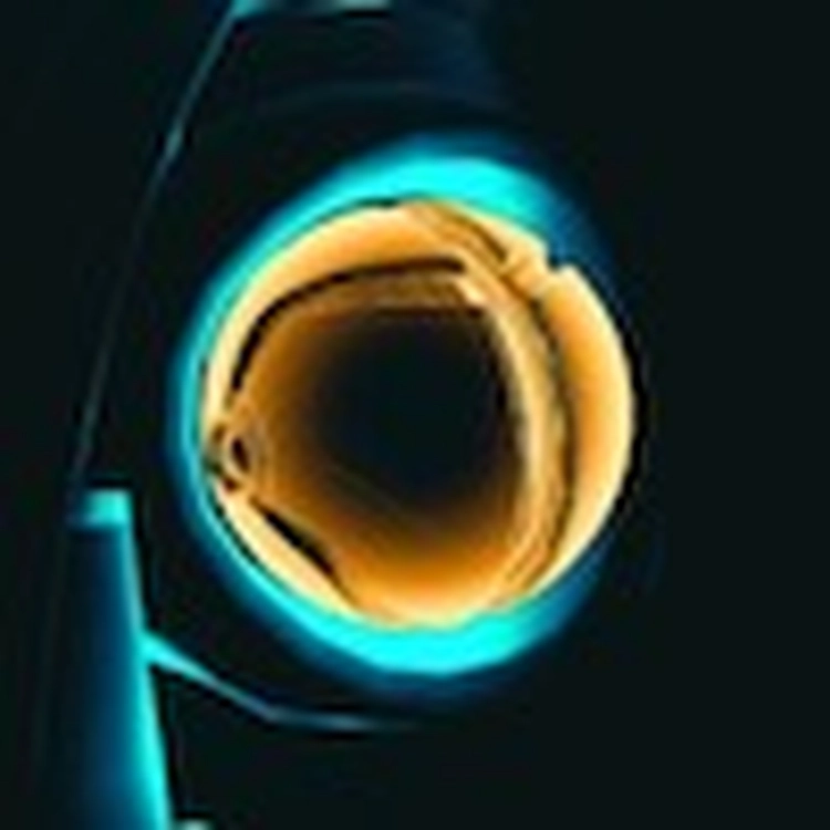 メトロイドプライム4_ボム・スロット_アイコン