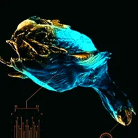 メトロイドプライム4_バーミス_アイコン